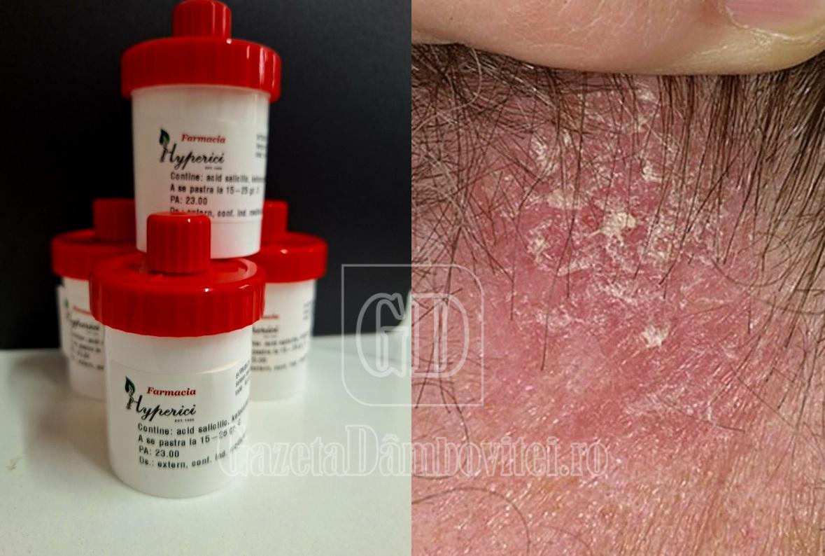 crema hyperici