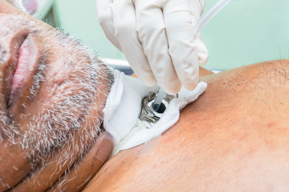 patients,with,cerebral,thrombosis,that,pierces,the,throat,and,inserts
